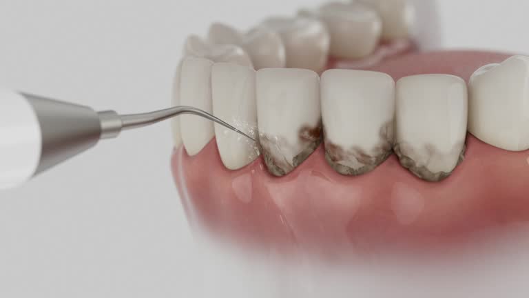 Reliable Root Canal Treatment contractor in Leslie County County, KY by Dentist Open Now